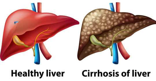 liver detox